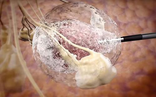 Chuyên gia dạy cách ăn uống lành mạnh và những cảnh báo quan trọng để "loại bỏ" ung thư