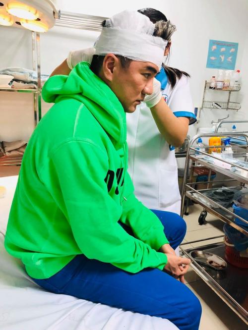 Đàm Vĩnh Hưng bất ngờ gặp tai nạn chảy máu đầu trên sân khấu vẫn gồng mình hát -Thạch Thảo 